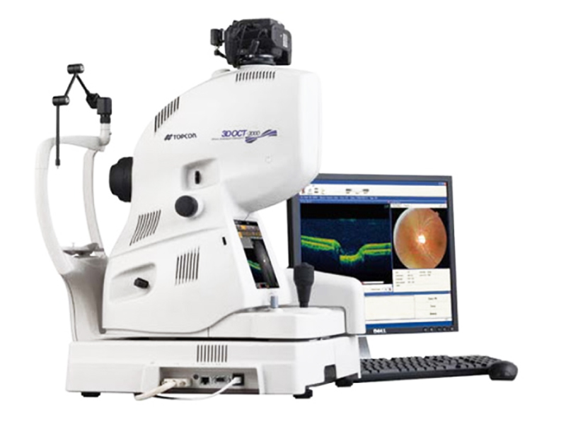 OCT retinal scanning