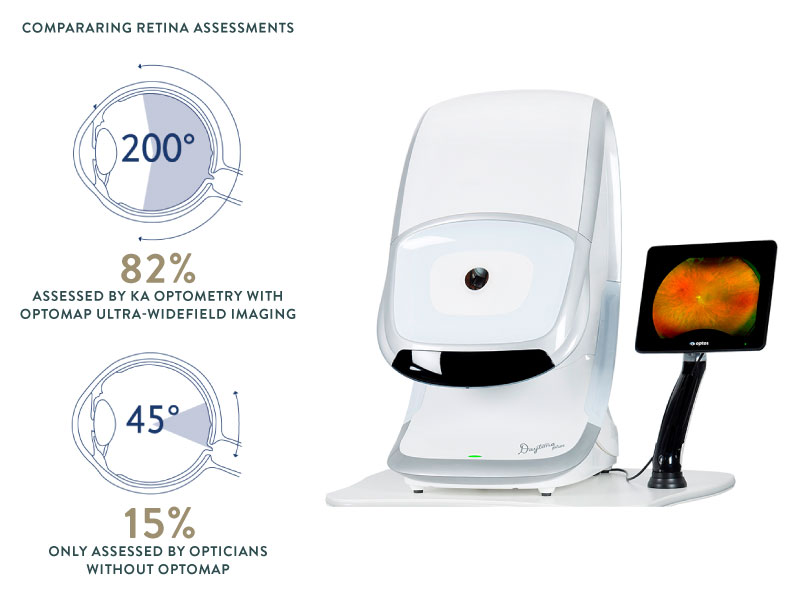 Optomap Retinal Imaging